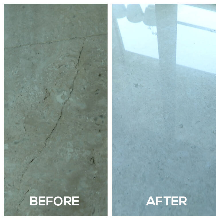 Before and after treatment